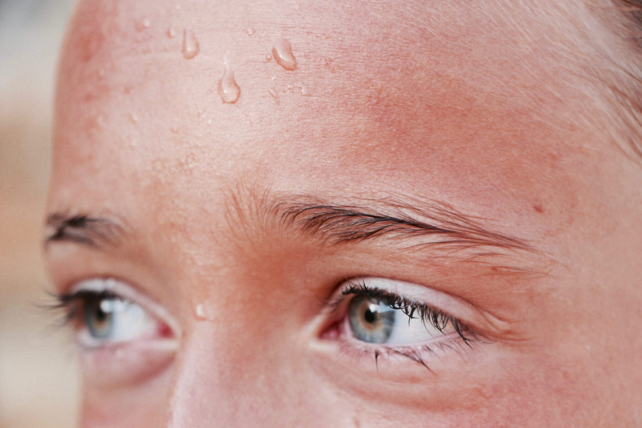 Enfermedades respiratorias: foto de la frente sudorosa de una joven de ojos azules